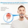 31cbb0fd7196ba8f Electronic Vacuum Tonsil Stone Remover Kit with 5 Suction Modes 10in1 Tonsil Stone Cleaner Mouth Cleaning Tool Oral Fresh Care