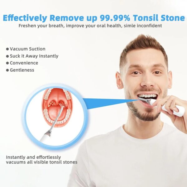 31cbb0fd7196ba8f Electronic Vacuum Tonsil Stone Remover Kit with 5 Suction Modes 10in1 Tonsil Stone Cleaner Mouth Cleaning Tool Oral Fresh Care