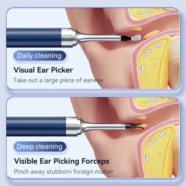 3687bfd8f6e55e6f Camera Wax Removal Otoscop with Light 3.2mm Silicone Spoon Ear Cleaner Visible Tweezer Cleaning