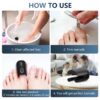 KTS Nail Fungus Laser Device Toenail Laser Therapy Machine Anti Fungal Laser Equipment for Onychomycosis 910nm 407nm USB Charge