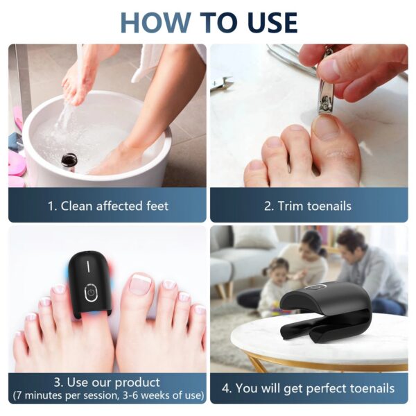 KTS Nail Fungus Laser Device Toenail Laser Therapy Machine Anti Fungal Laser Equipment for Onychomycosis 910nm 407nm USB Charge
