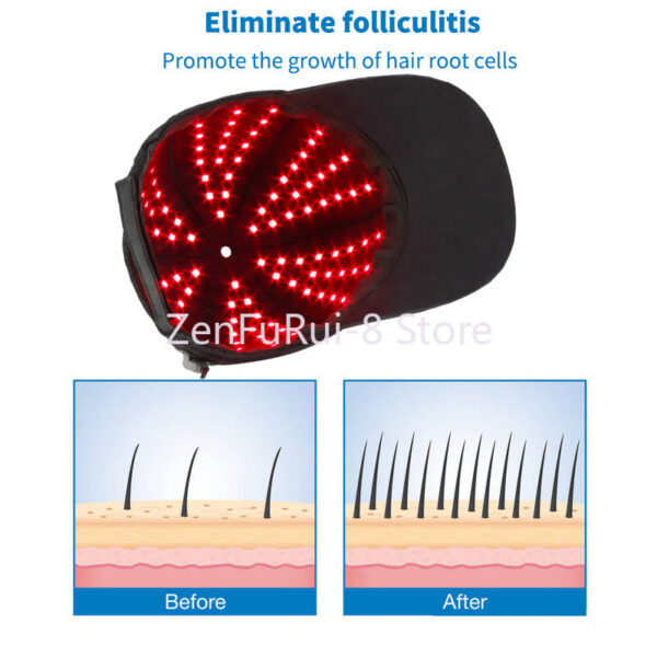 3fcd49d7676020b6 New Portable Red Lights 670NM And 810Nm Infrared for Loss Helmet Hair Growth highest wavelength red light therapy Hat