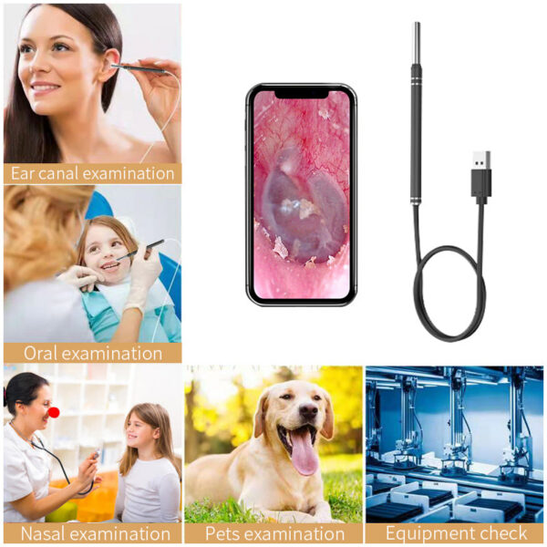 Smart Cleaner Endoscope Spoon Camera Ear Picker Cleaning Wax Removal Visual Earpick Wifi Mouth Nose Otoscope Support Android