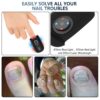KTS Nail Fungus Laser Device Toenail Laser Therapy Machine Anti Fungal Laser Equipment for Onychomycosis 910nm 407nm USB Charge
