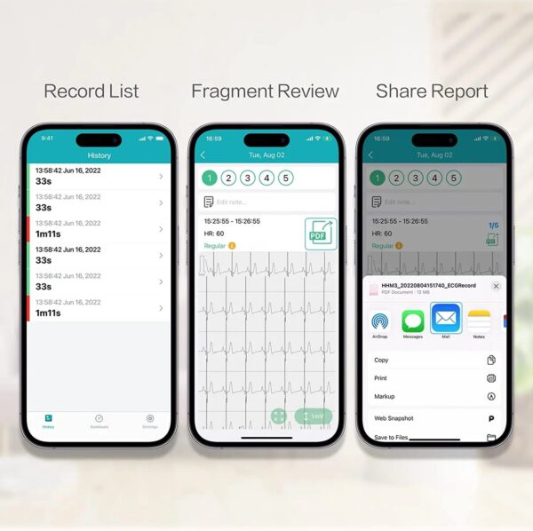 530d2cdee65592c9 Pocket ECG Monitoring Device with OLED Screen Bluetooth EKG Monitor for Rhythm Waveform, Free APP AI Analyze with iOS/Android