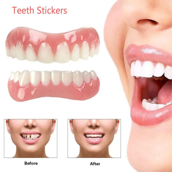 Sdatter Instant Big Smile Veneer Men's and Women's Silicone Artificial Teeth Braces Whitening Stic Comfortable