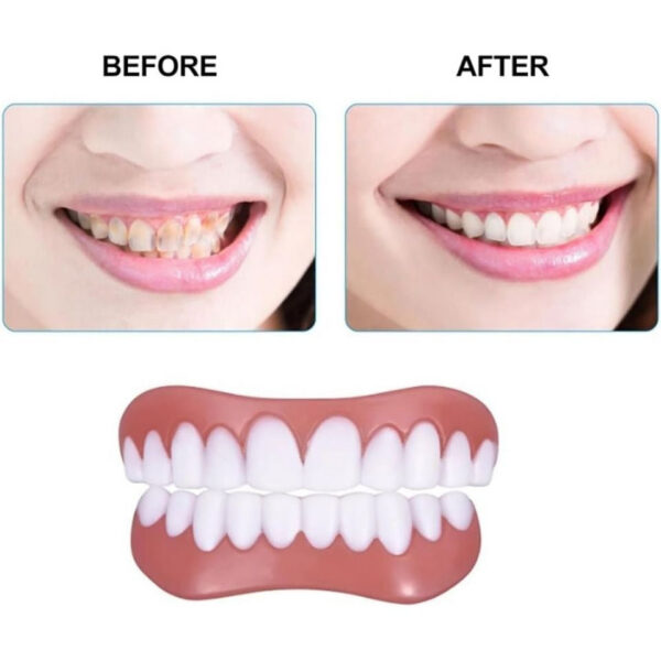 5841fd077a722989 Soft Comfortable Firm Denture Silicone Ree Kit Safe And Durable Instant Teeth