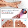 KTS Nail Fungus Laser Device Toenail Laser Therapy Machine Anti Fungal Laser Equipment for Onychomycosis 910nm 407nm USB Charge