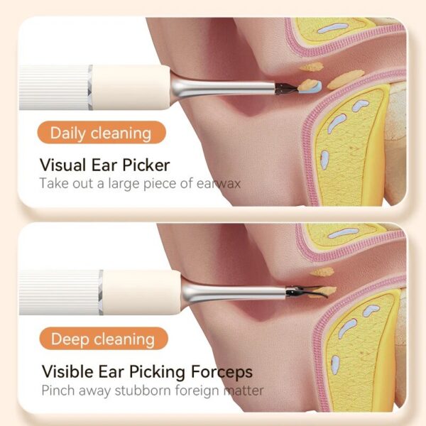 Wireless Cleaner Smart Visual Wax Removal Sticks WiFi Otoscope 3.2MM Camera Borescope with LED Lights 1920P HD Ear Care