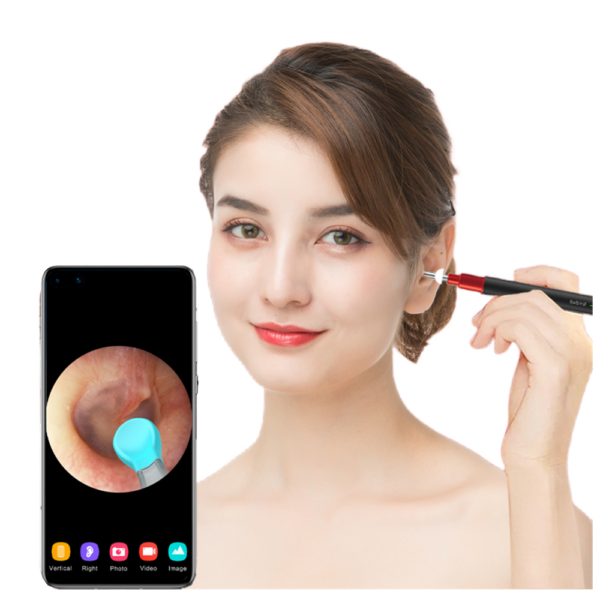 Bebird R1 X3 R3 Smart Visual Sticks Endoscope 300W High Precision Earpick Mini Camera Otoscope Health Care Ear Cleaner