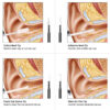 86be495f85de1588 Medical In Cleaning Endoscope Spoon Mini Camera Picker Wax Removal Visual Ear Mouth Nose Otoscope Support Android PC