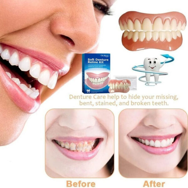 8be3fc1b744b436b Soft Comfortable Firm Denture Silicone Ree Kit Safe And Durable Instant Teeth