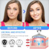 8ed93cab30204de2 Dropshipping Facial Massager Neck Facial Beauty Device Lifting Tighten Skin Care Tool