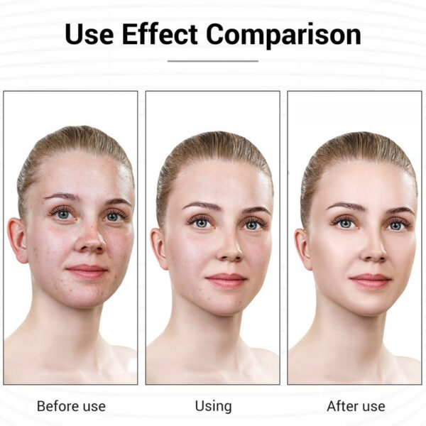97b418c59ea6d991 L E D Face Mask Light Therapy, 7 Colors Therapy Mask, Red & Blue for Face, Skin Care, Portable Rechargeable
