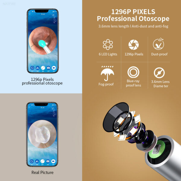 NATFIRE NE7 Smart Visual Sticks Otoscope 1296P Endoscope Wax Removal Tool Earpick Mini Camera Health Care Ear Cleaner