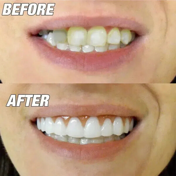 abdf4249d3278f01 New False Silicone Upper & Lower Perfect Laugh Veneers Dentures Paste Fake Braces Comfortable Teeth