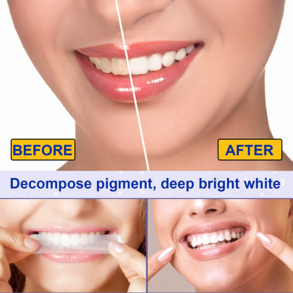 adeb10dfa6b5b7ee 5D Dental Patches Teeth Whitening Strips 7 Pairs of 28 Sheets