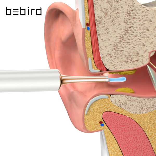Bebird T15 R1 Visual Ear Cleaner Minifit 2in1 Acne Wax Removal Tool HD1080P Otoscope IP67 Waterproof Endoscope Health Care