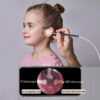 Smart Cleaner Endoscope Spoon Camera Ear Picker Cleaning Wax Removal Visual Earpick Wifi Mouth Nose Otoscope Support Android