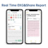 b5c29d73eca76d02 Pocket ECG Monitoring Device with OLED Screen Bluetooth EKG Monitor for Rhythm Waveform, Free APP AI Analyze with iOS/Android
