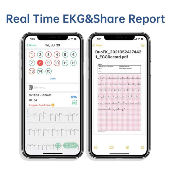 b5c29d73eca76d02 Pocket ECG Monitoring Device with OLED Screen Bluetooth EKG Monitor for Rhythm Waveform, Free APP AI Analyze with iOS/Android