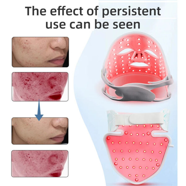 b7183fbe295aa1ff LED 8 Colors Face Mask and Neck Red Light Near Infrared Therapy Anti Aging Wrinkle Acne Pore Oil Control Skin Tighten Whiten