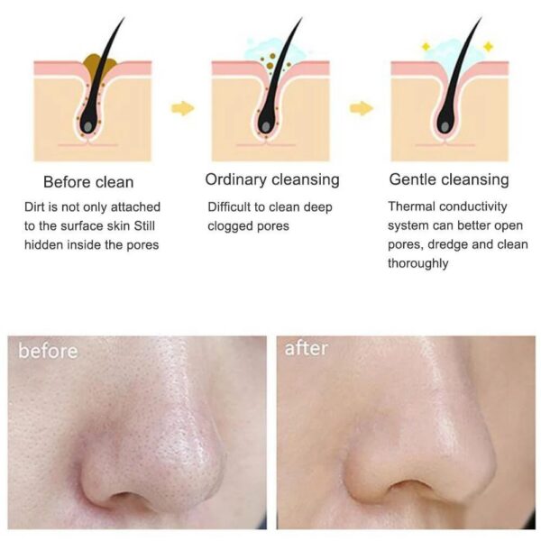Electric Silicone Facial Cleanser Massager Ultrasonic Vibrator Skincare Massage Tool Beauty hine Vibration Cleaning Of Pores