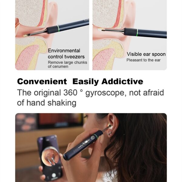 Bebird Note5 Cleaner Smart Visual Ear Wax Removal Sticks Endoscope 1000W High Precision Earpick Camera Otoscope Health Tool