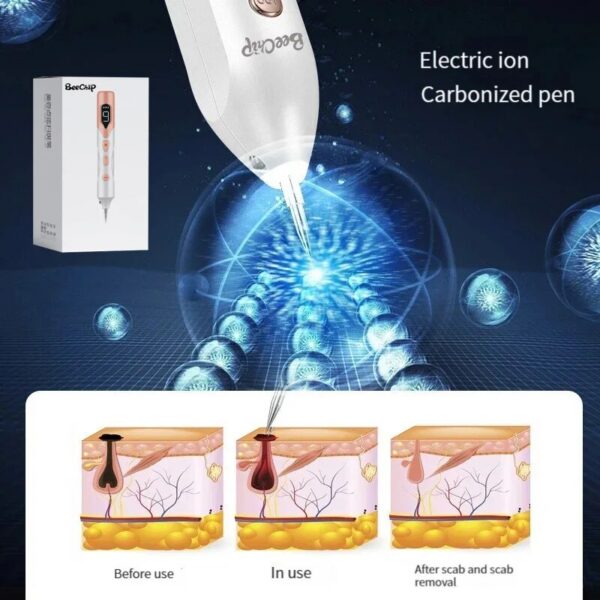 d7b5fde2976aeba7 Plasma Laser Cosmetic Pen Home Beauty Rejuvenation Instrument Electric Microneedle Lonized Carbonization Technology