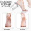 de2532624c5373bd USB Rechargeable Portable Vacuum Adsorption Grinder Electric Foot File Pedicure Tools Dead Skin Callus Remover Feet Sander