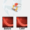 e35a115f59b74684 Andrology Massage Apparatus Infrared Heat Therapy Physiotherapy Prostate Calcification Treatment 전립선 치료제