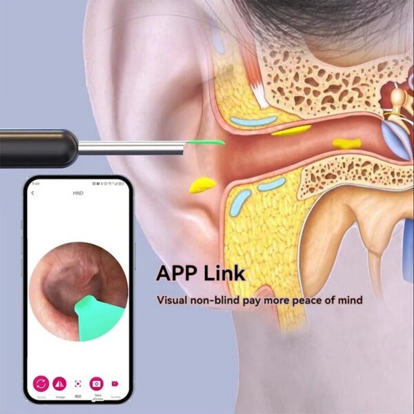 Wireless Wax Remover Luminous Otoscope Cleaner 1296P HD Visual Ear Sticks Endoscope Mini Camera Health Care