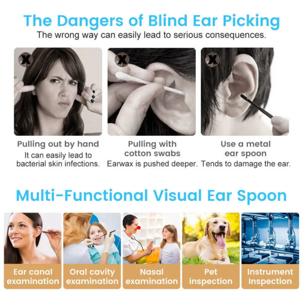 e8da4c22d8c01808 Care Supply Smart Cleaner Endoscope Spoon Camera Ear Picker Cleaning Wax Removal Visual Earpick Wifi Mouth Nose Otoscope Support Android 230524