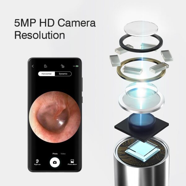KERUI Smart Wireless Visual Cleaner Spoon Safe Endoscope Earpick 5MP Mini Camera Wax Remover Otoscope Ear Tools Health Care