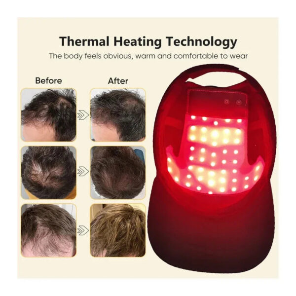 Red Fast Growth Cap Red&Infrared Light Therapy Device For Hair Loss Treatment With USB Charging Anti-hair