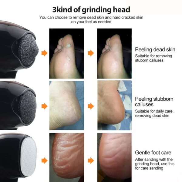 Electric Grinder for Foot Callus Sander Dead Skin Rupture Remover Pedicure with 3 Speeds Rechargeable Feet Heels Grind